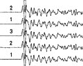 Vertical component seismograms from clustered icro-earthquakes on the San Andreas fault at Parkfield.